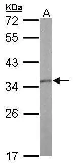 Sample (50 μg of whole cell lysate) A: mouse liver 12% SDS PAGE GTX113857 diluted at 1:1000 The HRP-conjugated anti-rabbit IgG antibody (GTX213110-01) was used to detect the primary antibody. Sample (50 μg of whole cell lysate) A: mouse liver 12% SDS PAGE GTX113857 diluted at 1:1000 The HRP-conjugated anti-rabbit IgG antibody (GTX213110-01) was used to detect the primary antibody.