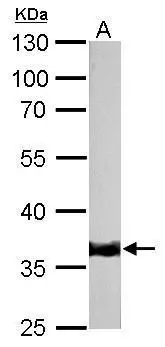 Tropomyosin 1 antibody detects TPM1 protein by western blot analysis. A. 50 μg rat muscle lysate/extract 10% SDS-PAGE Tropomyosin 1 antibody (GTX113857) dilution: 1:6000 The HRP-conjugated anti-rabbit IgG antibody (GTX213110-01) was used to detect the primary antibody. Tropomyosin 1 antibody detects TPM1 protein by western blot analysis. A. 50 μg rat muscle lysate/extract 10% SDS-PAGE Tropomyosin 1 antibody (GTX113857) dilution: 1:6000 The HRP-conjugated anti-rabbit IgG antibody (GTX213110-01) was used to detect the primary antibody.