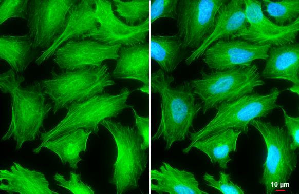 Tropomyosin 1 antibody detects Tropomyosin 1 protein at cytoskeleton by immunofluorescent analysis. Sample: HeLa cells were fixed in 4% paraformaldehyde at RT for 15 min. Green: Tropomyosin 1 stained by Tropomyosin 1 antibody (GTX113857) diluted at 1:500. Blue: Fluoroshield with DAPI (GTX30920). Scale bar= 10 μm. Tropomyosin 1 antibody detects Tropomyosin 1 protein at cytoskeleton by immunofluorescent analysis. Sample: HeLa cells were fixed in 4% paraformaldehyde at RT for 15 min. Green: Tropomyosin 1 stained by Tropomyosin 1 antibody (GTX113857) diluted at 1:500. Blue: Fluoroshield with DAPI (GTX30920). Scale bar= 10 μm.