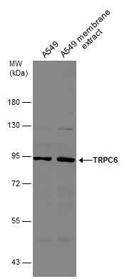 TRPC6 antibody [N1N3]