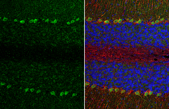 TRPC6 antibody [N1N3] detects TRPC6 protein at cytoplasm by immunohistochemical analysis. Sample: Paraffin-embedded mouse cerebellum. Green: TRPC6 stained by TRPC6 antibody [N1N3] (GTX113858) diluted at 1:500. Red: NF-H, a neuron marker, stained by NF-H antibody [GT114] (GTX634289) diluted at 1:500. Blue: Fluoroshield with DAPI (GTX30920). Antigen Retrieval: Citrate buffer, pH 6.0, 15 min