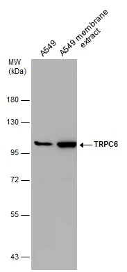 A549 whole cell and membrane extracts (30 μg) were separated by 7.5% SDS-PAGE, and the membrane was blotted with TRPC6 antibody (GTX113859) diluted at 1:1000.