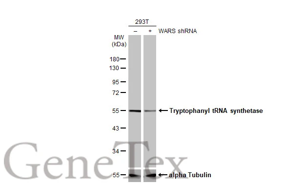 Non-transfected (–) and transfected (+) 293T whole cell extracts (30 μg) were separated by 10% SDS-PAGE, and the membrane was blotted with Tryptophanyl tRNA synthetase antibody (GTX113861) diluted at 1:10000. The HRP-conjugated anti-rabbit IgG antibody (GTX213110-01) was used to detect the primary antibody, and the signal was developed with Trident ECL plus-Enhanced. Non-transfected (–) and transfected (+) 293T whole cell extracts (30 μg) were separated by 10% SDS-PAGE, and the membrane was blotted with Tryptophanyl tRNA synthetase antibody (GTX113861) diluted at 1:10000. The HRP-conjugated anti-rabbit IgG antibody (GTX213110-01) was used to detect the primary antibody, and the signal was developed with Trident ECL plus-Enhanced.