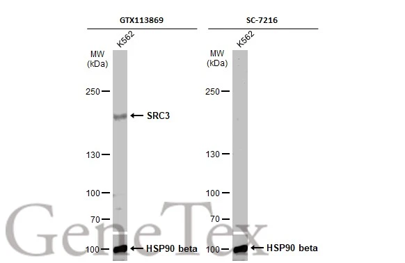 Whole cell extract (30 μg) was separated by 5% SDS-PAGE, and the membranes were blotted with SRC3 antibody [N1N2], N-term (GTX113869) diluted at 1:2000 and competitor's antibody (SC-7216) diluted at 1:200. The HRP-conjugated anti-rabbit IgG antibody (GTX213110-01) was used to detect the primary antibody. *The competitor is not affiliated with GeneTex and does not endorse this product.