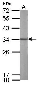 Sample (50 ug of whole cell lysate) A: mouse brain 12% SDS PAGE GTX113917 diluted at 1:1000 Sample (50 ug of whole cell lysate) A: mouse brain 12% SDS PAGE GTX113917 diluted at 1:1000