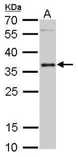 PIM2 antibody detects PIM2 protein by Western blot analysis. A. 50 μg mouse testis lysate/extract 12 % SDS-PAGE PIM2 antibody (GTX113928) dilution: 1:500