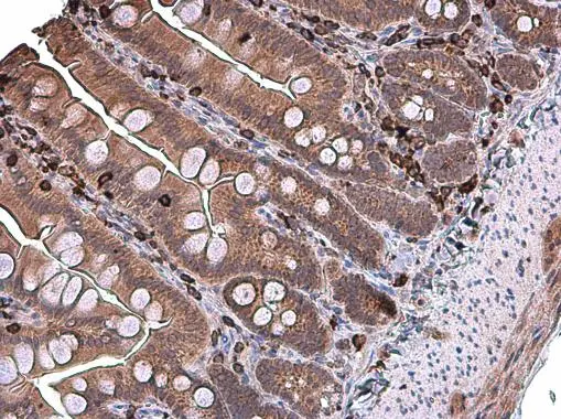 Coronin 1A antibody [N1N3] detects Coronin 1A protein at cytoplasm in rat intestine by immunohistochemical analysis. Sample: Paraffin-embedded rat intestine. Coronin 1A antibody [N1N3] (GTX113931) diluted at 1:200.