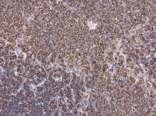 Coronin 1A antibody [N1N3] detects Coronin 1A protein at cytoplasm in rat spleen by immunohistochemical analysis. Sample: Paraffin-embedded rat spleen. Coronin 1A antibody [N1N3] (GTX113931) diluted at 1:200.