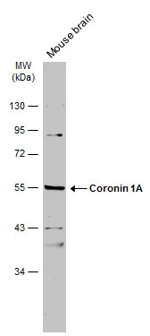 Mouse tissue extract (50 μg) was separated by 10% SDS-PAGE, and the membrane was blotted with Coronin 1A antibody [N1N3] (GTX113931) diluted at 1:1000. The HRP-conjugated anti-rabbit IgG antibody (GTX213110-01) was used to detect the primary antibody.