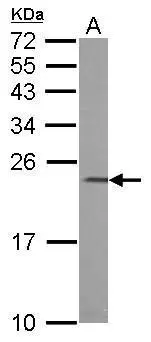 Calcium binding protein P22 antibody detects CHP protein by western blot analysis. A. 50 μg mouse liver lysate/extract 12% SDS-PAGE Calcium binding protein P22 antibody (GTX113936) dilution: 1:1000 The HRP-conjugated anti-rabbit IgG antibody (GTX213110-01) was used to detect the primary antibody.