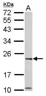 Calcium binding protein P22 antibody detects CHP protein by western blot analysis. A. 50 μg rat liver lysate/extract 12% SDS-PAGE Calcium binding protein P22 antibody (GTX113936) dilution: 1:1000 The HRP-conjugated anti-rabbit IgG antibody (GTX213110-01) was used to detect the primary antibody.