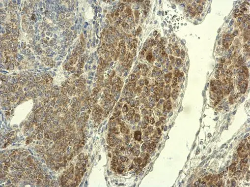 PAD4 antibody detects PAD4 protein at cytoplasm on mouse ovary by immunohistochemical analysis. Sample: Paraffin-embedded mouse ovary. PAD4 antibody (GTX113945) diluted at 1:500. 
 Antigen Retrieval: Trilogy? (EDTA based, pH 8.0) buffer, 15min