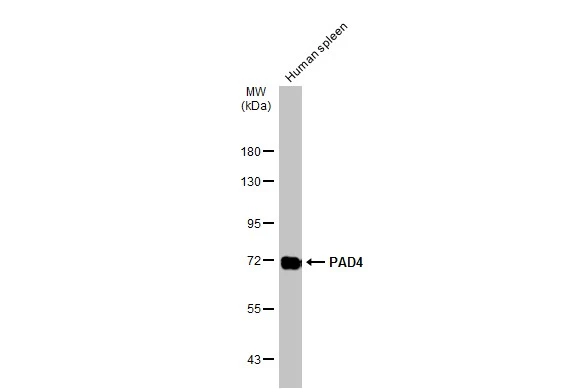 Human tissue extract (30 μg) was separated by 7.5% SDS-PAGE, and the membrane was blotted with PAD4 antibody (GTX113945) diluted at 1:1000. The HRP-conjugated anti-rabbit IgG antibody (GTX213110-01) was used to detect the primary antibody.