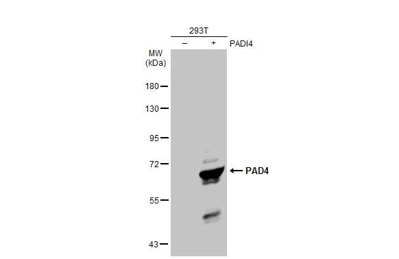 Non-transfected (–) and transfected (+) 293T whole cell extracts (30 μg) were separated by 7.5% SDS-PAGE, and the membrane was blotted with PAD4 antibody (GTX113945) diluted at 1:5000. The HRP-conjugated anti-rabbit IgG antibody (GTX213110-01) was used to detect the primary antibody.