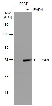 Non-transfected (–) and transfected (+) 293T whole cell extracts (30 μg) were separated by 7.5% SDS-PAGE, and the membrane was blotted with PAD4 antibody [N1N3] (GTX113946) diluted at 1:5000. The HRP-conjugated anti-rabbit IgG antibody (GTX213110-01) was used to detect the primary antibody.