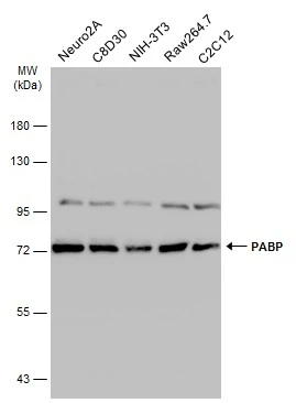 Various whole cell extracts (30 μg) were separated by 7.5% SDS-PAGE, and the membrane was blotted with PABP antibody (GTX113954) diluted at 1:1000. The HRP-conjugated anti-rabbit IgG antibody (GTX213110-01) was used to detect the primary antibody.