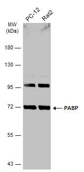 Various whole cell extracts (30 μg) were separated by 7.5% SDS-PAGE, and the membrane was blotted with PABP antibody (GTX113954) diluted at 1:1000. The HRP-conjugated anti-rabbit IgG antibody (GTX213110-01) was used to detect the primary antibody.