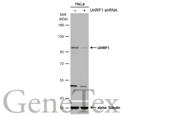 Non-transfected (–) and transfected (+) HeLa whole cell extracts (50 μg) were separated by 7.5% SDS-PAGE, and the membrane was blotted with UHRF1 antibody (GTX113963) diluted at 1:500. The HRP-conjugated anti-rabbit IgG antibody (GTX213110-01) was used to detect the primary antibody. Non-transfected (–) and transfected (+) HeLa whole cell extracts (50 μg) were separated by 7.5% SDS-PAGE, and the membrane was blotted with UHRF1 antibody (GTX113963) diluted at 1:500. The HRP-conjugated anti-rabbit IgG antibody (GTX213110-01) was used to detect the primary antibody.