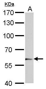 UGT1A6 antibody detects UGT1A6 protein by Western blot analysis. A. 50 μg mouse liver lysate/extract 7.5 % SDS-PAGE UGT1A6 antibody (GTX113980) dilution: 1:500 UGT1A6 antibody detects UGT1A6 protein by Western blot analysis. A. 50 μg mouse liver lysate/extract 7.5 % SDS-PAGE UGT1A6 antibody (GTX113980) dilution: 1:500