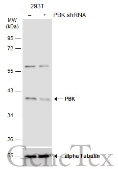 Non-transfected (–) and transfected (+) 293T whole cell extracts (30 μg) were separated by 10% SDS-PAGE, and the membrane was blotted with PBK antibody [N2C3] (GTX113982) diluted at 1:15000. The HRP-conjugated anti-rabbit IgG antibody (GTX213110-01) was used to detect the primary antibody.