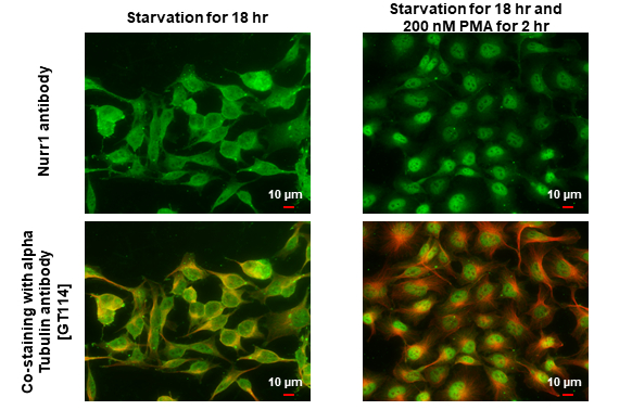Nurr1 antibody detects Nurr1 protein by immunofluorescent analysis. Sample: Mock and treated HeLa cells were fixed in 4% paraformaldehyde at RT for 15 min. Green: Nurr1 stained by Nurr1 antibody (GTX114045) diluted at 1:500. Red: alpha Tubulin, a cytoskeleton marker, stained by alpha Tubulin antibody [GT114] (GTX628802) diluted at 1:1000.
