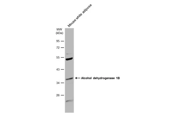 Mouse tissue extract (50 μg) was separated by 10% SDS-PAGE, and the membrane was blotted with Alcohol dehydrogenase 1B antibody [N2C3] (GTX114054) diluted at 1:1000. The HRP-conjugated anti-rabbit IgG antibody (GTX213110-01) was used to detect the primary antibody.