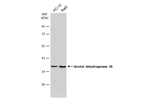 Various whole cell extracts (30 μg) were separated by 10% SDS-PAGE, and the membrane was blotted with Alcohol dehydrogenase 1B antibody [N2C3] (GTX114054) diluted at 1:1000. The HRP-conjugated anti-rabbit IgG antibody (GTX213110-01) was used to detect the primary antibody.