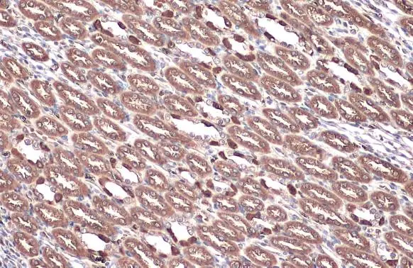 ATP6V1E1 antibody