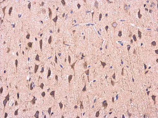 COMT antibody detects COMT protein at cytoplasm in Rat brain by immunohistochemical analysis. Sample: Paraffin-embedded Rat brain. COMT antibody (GTX114062) diluted at 1:500.
Antigen Retrieval: Citrate buffer, pH 6.0, 15 min