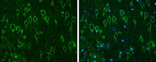 COMT antibody detects COMT protein at cytoplasm in rat brain by immunohistochemical analysis. Sample: Paraffin-embedded rat brain. COMT antibody (GTX114062) diluted at 1:500. 
 Antigen Retrieval: Citrate buffer, pH 6.0, 15 min