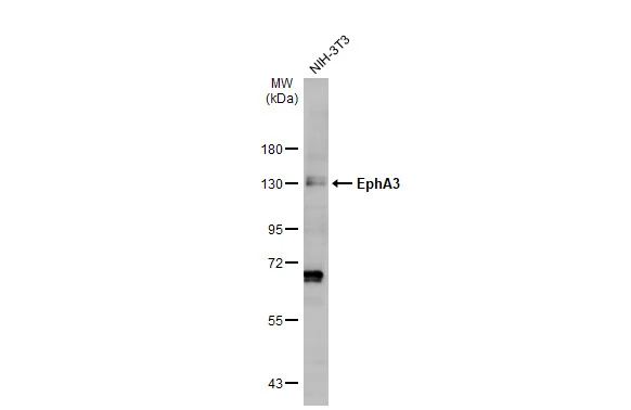 Whole cell extract (30 μg) was separated by 7.5% SDS-PAGE, and the membrane was blotted with EphA3 antibody [N1N3] (GTX114067) diluted at 1:1500. The HRP-conjugated anti-rabbit IgG antibody (GTX213110-01) was used to detect the primary antibody, and the signal was developed with Trident ECL plus-Enhanced.