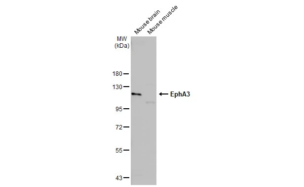 Mouse tissue extract (50 μg) were separated by 7.5% SDS-PAGE, and the membrane was blotted with EphA3 antibody [N1N3] (GTX114067) diluted at 1:1500. The HRP-conjugated anti-rabbit IgG antibody (GTX213110-01) was used to detect the primary antibody.