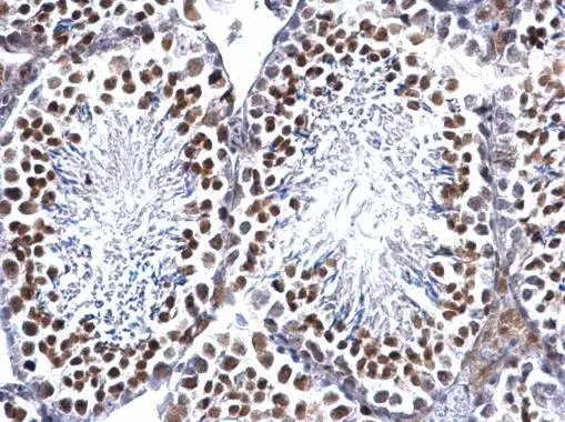 EWSR1 antibody detects EWSR1 protein at nucleus on mouse testis by immunohistochemical analysis. Sample: Paraffin-embedded mouse testis. EWSR1 antibody (GTX114069) dilution: 1:500.
Antigen Retrieval: Trilogy? (EDTA based, pH 8.0) buffer, 15min