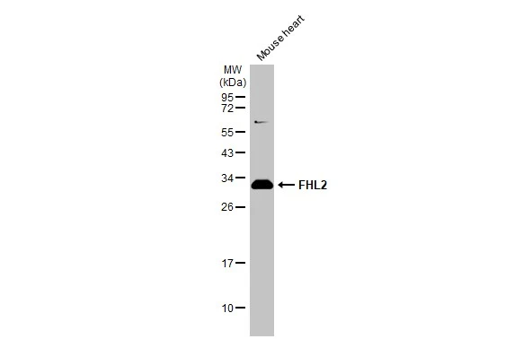 Mouse tissue extract (50 μg) was separated by 12% SDS-PAGE, and the membrane was blotted with FHL2 antibody (GTX114071) diluted at 1:1000. The HRP-conjugated anti-rabbit IgG antibody (GTX213110-01) was used to detect the primary antibody. Mouse tissue extract (50 μg) was separated by 12% SDS-PAGE, and the membrane was blotted with FHL2 antibody (GTX114071) diluted at 1:1000. The HRP-conjugated anti-rabbit IgG antibody (GTX213110-01) was used to detect the primary antibody.