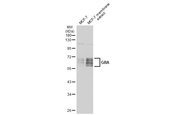 MCF-7 whole cell and membrane extracts (30 μg) were separated by 10% SDS-PAGE, and the membrane was blotted with GBA antibody (GTX114073) diluted at 1:500. The HRP-conjugated anti-rabbit IgG antibody (GTX213110-01) was used to detect the primary antibody.