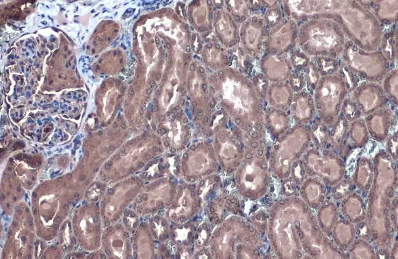 GBA antibody detects GBA protein at cytoplasm by immunohistochemical analysis. Sample: Paraffin-embedded rat kidney. GBA stained by GBA antibody (GTX114073) diluted at 1:1000. Antigen Retrieval: Citrate buffer, pH 6.0, 15 min