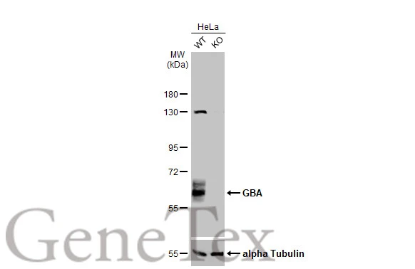 Wild-type (WT) and GBA knockout (KO) HeLa cell extracts (30 μg) were separated by 7.5% SDS-PAGE, and the membrane was blotted with GBA antibody (GTX114073) diluted at 1:500. The HRP-conjugated anti-rabbit IgG antibody (GTX213110-01) was used to detect the primary antibody.