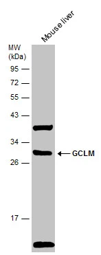 Mouse tissue extract (50 μg) was separated by 12% SDS-PAGE, and the membrane was blotted with GCLM antibody (GTX114075) diluted at 1:2000. The HRP-conjugated anti-rabbit IgG antibody (GTX213110-01) was used to detect the primary antibody.