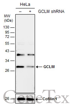 Non-transfected (–) and transfected (+) HeLa whole cell extracts (30 μg) were separated by 12% SDS-PAGE, and the membrane was blotted with GCLM antibody (GTX114075) diluted at 1:2000. The HRP-conjugated anti-rabbit IgG antibody (GTX213110-01) was used to detect the primary antibody.