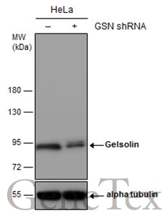 Non-transfected (–) and transfected (+) HeLa whole cell extracts (30 μg) were separated by 7.5% SDS-PAGE, and the membrane was blotted with Gelsolin antibody (GTX114078) diluted at 1:500. The HRP-conjugated anti-rabbit IgG antibody (GTX213110-01) was used to detect the primary antibody. Non-transfected (–) and transfected (+) HeLa whole cell extracts (30 μg) were separated by 7.5% SDS-PAGE, and the membrane was blotted with Gelsolin antibody (GTX114078) diluted at 1:500. The HRP-conjugated anti-rabbit IgG antibody (GTX213110-01) was used to detect the primary antibody.