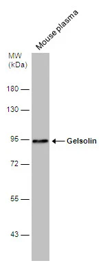 Mouse tissue extract (50 μg) was separated by 7.5% SDS-PAGE, and the membrane was blotted with Gelsolin antibody (GTX114078) diluted at 1:1000. The HRP-conjugated anti-rabbit IgG antibody (GTX213110-01) was used to detect the primary antibody.
