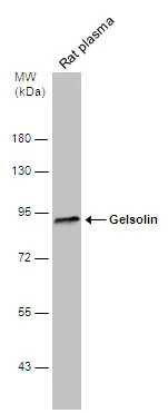Rat tissue extract (50 μg) was separated by 7.5% SDS-PAGE, and the membrane was blotted with Gelsolin antibody (GTX114078) diluted at 1:1000. The HRP-conjugated anti-rabbit IgG antibody (GTX213110-01) was used to detect the primary antibody. Rat tissue extract (50 μg) was separated by 7.5% SDS-PAGE, and the membrane was blotted with Gelsolin antibody (GTX114078) diluted at 1:1000. The HRP-conjugated anti-rabbit IgG antibody (GTX213110-01) was used to detect the primary antibody.