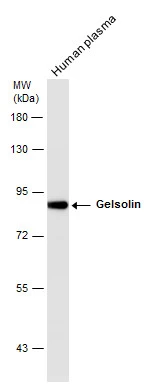 Human tissue extract (30 μg) was separated by 7.5% SDS-PAGE, and the membrane was blotted with Gelsolin antibody (GTX114078) diluted at 1:1000. The HRP-conjugated anti-rabbit IgG antibody (GTX213110-01) was used to detect the primary antibody. Human tissue extract (30 μg) was separated by 7.5% SDS-PAGE, and the membrane was blotted with Gelsolin antibody (GTX114078) diluted at 1:1000. The HRP-conjugated anti-rabbit IgG antibody (GTX213110-01) was used to detect the primary antibody.
