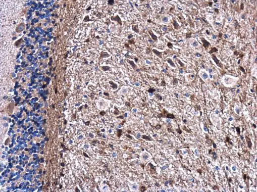 Gelsolin antibody detects Gelsolin protein at cytoplasm in mouse brain by immunohistochemical analysis. Sample: Paraffin-embedded mouse brain. Gelsolin antibody (GTX114078) diluted at 1:500.
Antigen Retrieval: Citrate buffer, pH 6.0, 15 min Gelsolin antibody detects Gelsolin protein at cytoplasm in mouse brain by immunohistochemical analysis. Sample: Paraffin-embedded mouse brain. Gelsolin antibody (GTX114078) diluted at 1:500.
Antigen Retrieval: Citrate buffer, pH 6.0, 15 min
