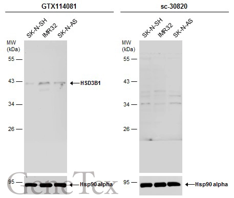 Various whole cell extracts (30 μg) were separated by 10% SDS-PAGE, and the membranes were blotted with HSD3B1 antibody [N1C1] (GTX114081) diluted at 1:500 and competitor's antibody (sc-30820) diluted at 1:100. The HRP-conjugated anti-rabbit IgG antibody (GTX213110-01) was used to detect the primary antibody.