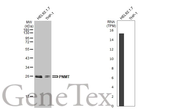 Various whole cell extracts (30 μg) were separated by 12% SDS-PAGE, and the membrane was blotted with PNMT antibody [N2C3] (GTX114098) diluted at 1:1000. The HRP-conjugated anti-rabbit IgG antibody (GTX213110-01) was used to detect the primary antibody. Corresponding RNA expression data for the same cell lines are based on Human Protein Atlas program.