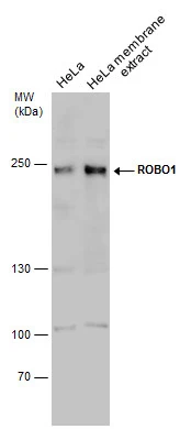 HeLa whole cell and membrane extracts (30 μg) were separated by 5% SDS-PAGE, and the membrane was blotted with ROBO1 antibody (GTX114103) diluted at 1:1000.
