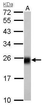 NDUFS8 antibody detects NDUFS8 protein by Western blot analysis. A. 50 μg rat brain lysate/extract 12 % SDS-PAGE NDUFS8 antibody (GTX114119) dilution: 1:1000