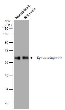 Various tissue extracts (10 μg) were separated by 10% SDS-PAGE, and the membrane was blotted with Synaptotagmin 1 antibody [N1C2] (GTX114124) diluted at 1:5000. The HRP-conjugated anti-rabbit IgG antibody (GTX213110-01) was used to detect the primary antibody.
