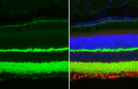 Synaptotagmin 1 antibody [N1C2] detects Synaptotagmin 1 protein at cell membrane and cytoplasm by immunohistochemical analysis. Sample: Paraffin-embedded mouse eye. Green: Synaptotagmin 1 stained by Synaptotagmin 1 antibody [N1C2] (GTX114124) diluted at 1:250. Red: beta Tubulin 3/ Tuj1, a cytoskeleton marker, stained by beta Tubulin 3/ Tuj1 antibody [GT11710] (GTX631836) diluted at 1:500. Blue: Fluoroshield with DAPI (GTX30920). Antigen Retrieval: Citrate buffer, pH 6.0, 15 min